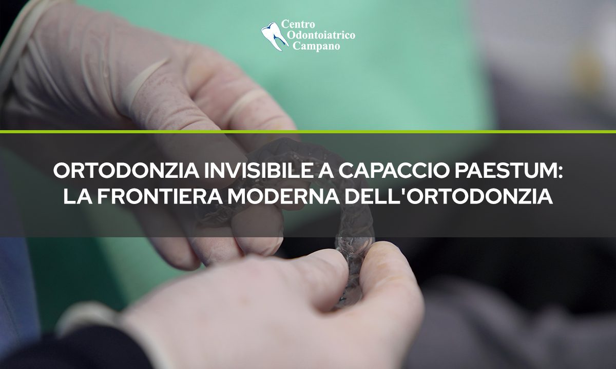 Implantologia-Invisibile-a-Capaccio-Paestum-La-Frontiera-Moderna-dellOrtodonzia-Quando-e-il-Momento-Giusto-Centro-Odontoiatrico-Campano-Blog-1024x614