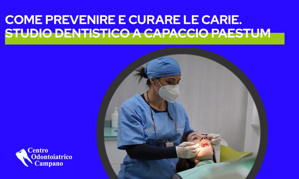Prevenire e curare le carie: studio dentistico a capaccio paestum---copertina-blog---Centro-Odontoiatrico-Campano