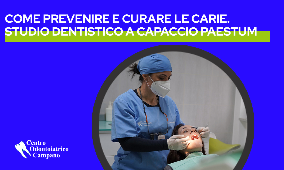 Prevenire e curare le carie: studio dentistico a capaccio paestum---copertina-blog---Centro-Odontoiatrico-Campano
