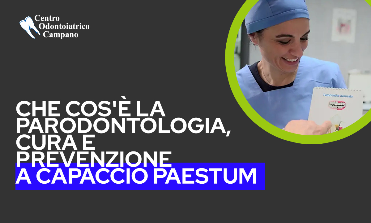 Cos-è-la-paradontologia-cura-e-prevenzione-a-capaccio-paestum---copertina-blog---Centro-Odontoiatrico-Campano