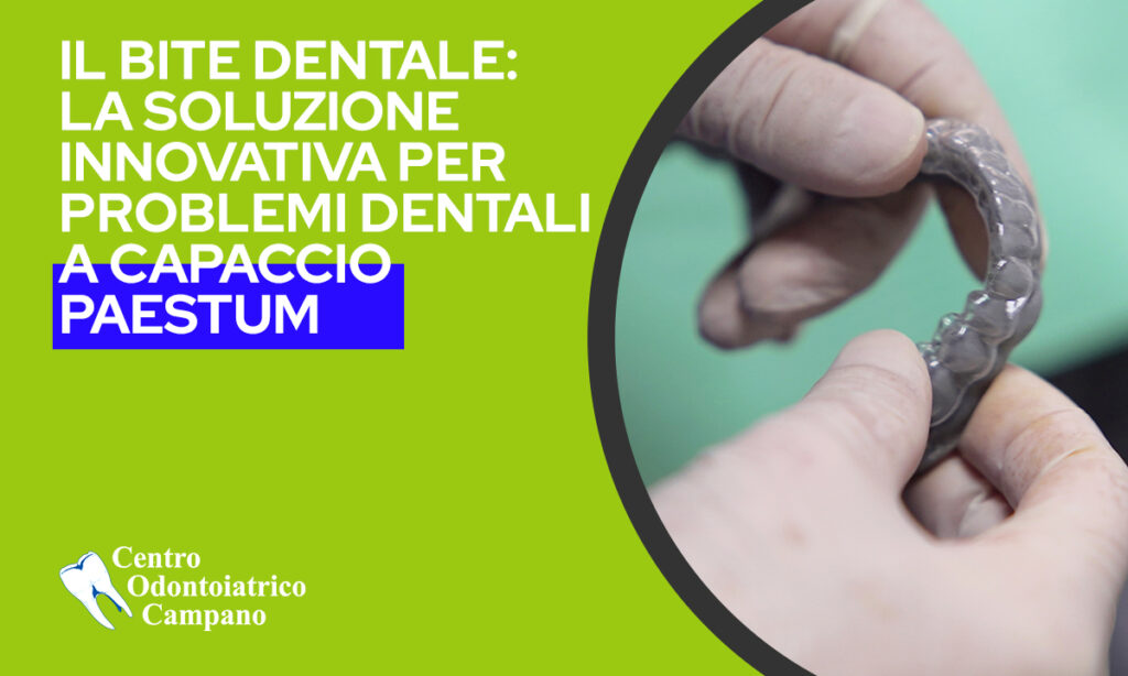 Bite Dentale studio dentistico a capaccio paestum---copertina-blog---Centro-Odontoiatrico-Campano